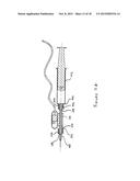 METHOD OF TUNING A VIBRATING MEDICAL DEVICE AND A CONNECTOR FOR THE SAME diagram and image