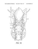 Respiration Sensors For Recording Of Triggered Respiratory Signals In     Neurostimulators diagram and image