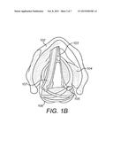 Respiration Sensors For Recording Of Triggered Respiratory Signals In     Neurostimulators diagram and image