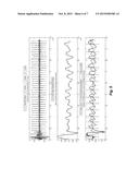 Respiration Sensors For Recording Of Triggered Respiratory Signals In     Neurostimulators diagram and image