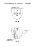 TONGUE STIMULATION FOR COMMUNICATION OF INFORMATION TO A USER diagram and image
