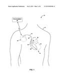 DETERMINATION OF HEMODYNAMIC INTOLERANCE OF VENTRICULAR PACING diagram and image