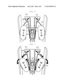 BODY-SHAPE CORRECTION APPARATUS diagram and image