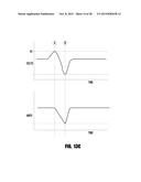 METHOD AND SYSTEM TO USE AC WELDING WAVEFORM AND ENHANCED CONSUMABLE TO     IMPROVE WELDING OF GALVANIZED WORKPIECE diagram and image