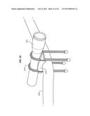 TIE WRAP FOR BUNDLING OBJECTS diagram and image