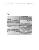 PEPTIDES THAT STIMULATE SUBCUTANEOUS ADIPOGENESIS diagram and image