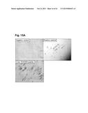 PEPTIDES THAT STIMULATE SUBCUTANEOUS ADIPOGENESIS diagram and image