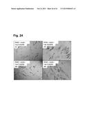 PEPTIDES THAT STIMULATE SUBCUTANEOUS ADIPOGENESIS diagram and image