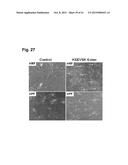 PEPTIDES THAT STIMULATE SUBCUTANEOUS ADIPOGENESIS diagram and image