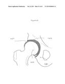 HYDROPHOBIC AND HYDROPHILIC INTERPENETRATING POLYMER NETWORKS DERIVED FROM     HYDROPHOBIC POLYMERS AND METHODS OF PREPARING THE SAME diagram and image