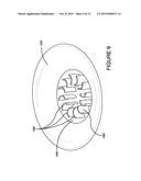 SINGLE USE CENTRIFUGE SYSTEM FOR HIGHLY CONCENTRATED AND/OR TURBID FEEDS diagram and image