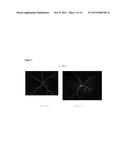 Compositions and Methods for the Diagnosis of Retinal Neovascularization diagram and image