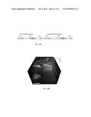 ACTIVE TRANSPORT OF CHARGED MOLECULES INTO, WITHIN, AND/OR FROM CHARGED     MATRICES diagram and image