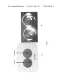 DROPLET INTERFACES diagram and image