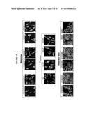 IASPP PHOSPHORYLATION AND METASTATIC POTENTIAL diagram and image