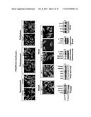 IASPP PHOSPHORYLATION AND METASTATIC POTENTIAL diagram and image