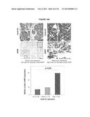 IASPP PHOSPHORYLATION AND METASTATIC POTENTIAL diagram and image