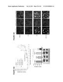 IASPP PHOSPHORYLATION AND METASTATIC POTENTIAL diagram and image