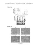 IASPP PHOSPHORYLATION AND METASTATIC POTENTIAL diagram and image