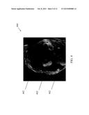 Methods and Systems for Acquiring Multiple Interleaved Slices in Magnetic     Resonance Imaging diagram and image