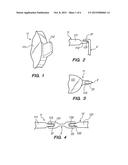 Eyeglasses diagram and image