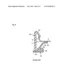 GROMMET diagram and image