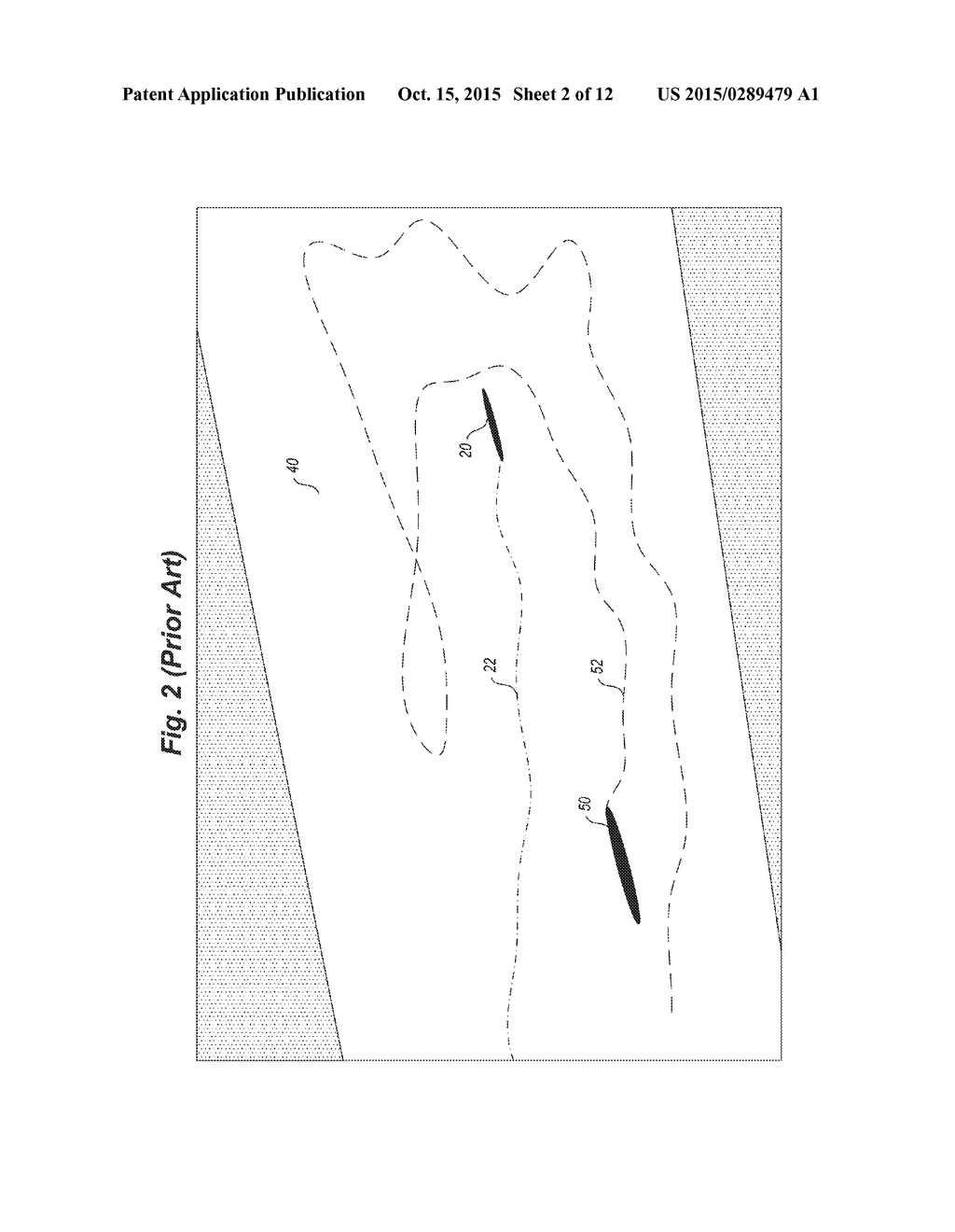 ACOUSTIC TAG HAVING A DIGESTIBLE FUSE - diagram, schematic, and image 03