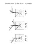 METHOD AND APPARATUS FOR EXTRACTION OF FOLICULAR UNITS diagram and image