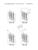 METHOD AND APPARATUS FOR EXTRACTION OF FOLICULAR UNITS diagram and image