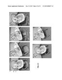 Repositionable Infant Support Structures diagram and image