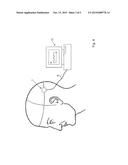 MICROELECTRODE ARRAY FOR AN ELECTROCORTICOGRAM diagram and image