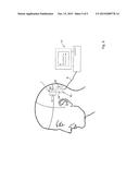 MICROELECTRODE ARRAY FOR AN ELECTROCORTICOGRAM diagram and image