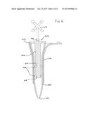 TISSUE RETRACTOR APPARATUS AND METHODS diagram and image