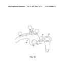 TISSUE RETRACTOR APPARATUS AND METHODS diagram and image