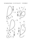 MULTIPLE LOOP SURGICAL SNARE ASSEMBLY AND SUTURING METHODS THEREOF diagram and image