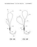 MULTIPLE LOOP SURGICAL SNARE ASSEMBLY AND SUTURING METHODS THEREOF diagram and image