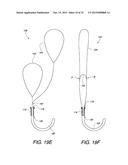 MULTIPLE LOOP SURGICAL SNARE ASSEMBLY AND SUTURING METHODS THEREOF diagram and image