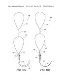 MULTIPLE LOOP SURGICAL SNARE ASSEMBLY AND SUTURING METHODS THEREOF diagram and image