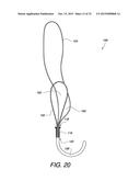 MULTIPLE LOOP SURGICAL SNARE ASSEMBLY AND SUTURING METHODS THEREOF diagram and image