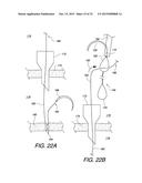 MULTIPLE LOOP SURGICAL SNARE ASSEMBLY AND SUTURING METHODS THEREOF diagram and image