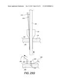 MULTIPLE LOOP SURGICAL SNARE ASSEMBLY AND SUTURING METHODS THEREOF diagram and image