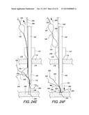 MULTIPLE LOOP SURGICAL SNARE ASSEMBLY AND SUTURING METHODS THEREOF diagram and image