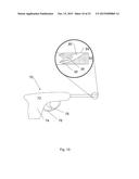 Arthroscopic Method and Apparatus for Rotator Cuff Repair diagram and image