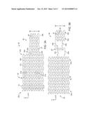 INTRAVASCULAR DEVICES SUPPORTING AN ARTERIOVENOUS FISTULA diagram and image