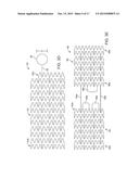 INTRAVASCULAR DEVICES SUPPORTING AN ARTERIOVENOUS FISTULA diagram and image