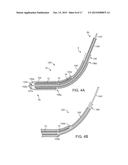 INTRAVASCULAR DEVICES SUPPORTING AN ARTERIOVENOUS FISTULA diagram and image