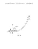 INTRAVASCULAR DEVICES SUPPORTING AN ARTERIOVENOUS FISTULA diagram and image