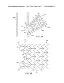 INTRAVASCULAR DEVICES SUPPORTING AN ARTERIOVENOUS FISTULA diagram and image