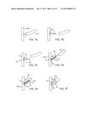 INTRAVASCULAR DEVICES SUPPORTING AN ARTERIOVENOUS FISTULA diagram and image