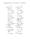 INTRAVASCULAR DEVICES SUPPORTING AN ARTERIOVENOUS FISTULA diagram and image